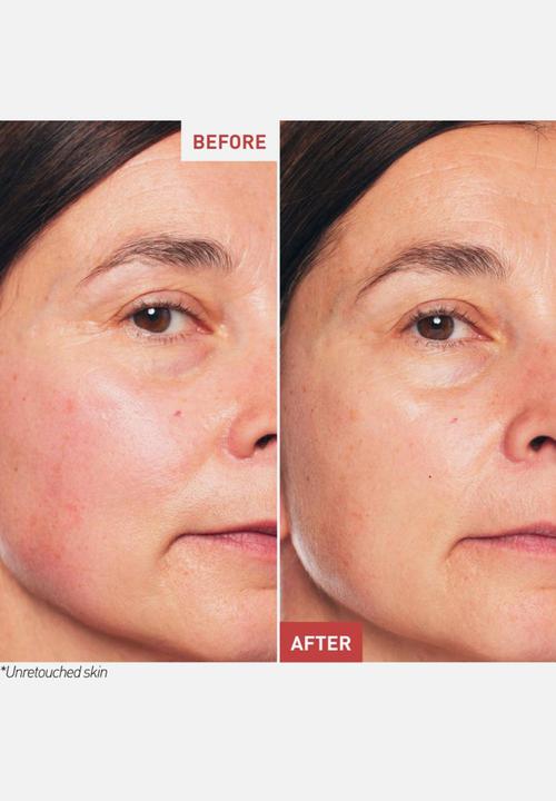 Erborian - Skin Therapy Light - 30ml