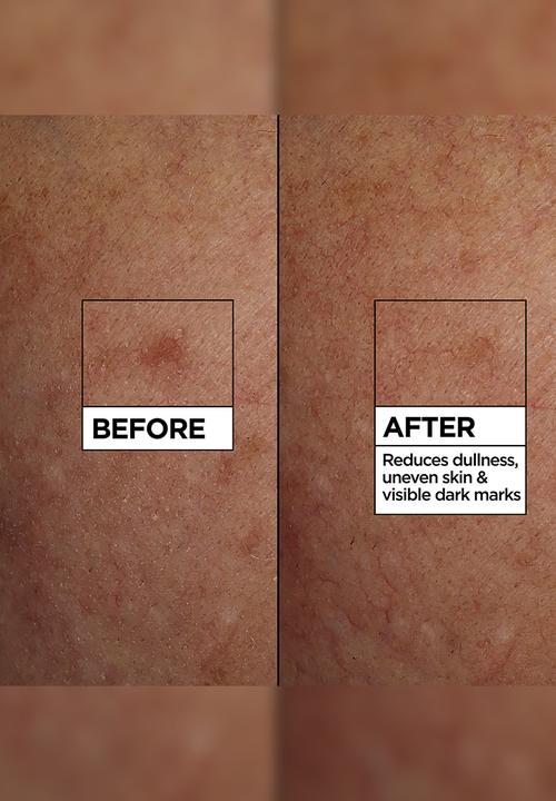 Garnier - Even & Bright Vitamin C Serum Cleanser - 100ml