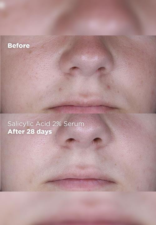 Skin Republic - Salicylic Acid 2% Serum