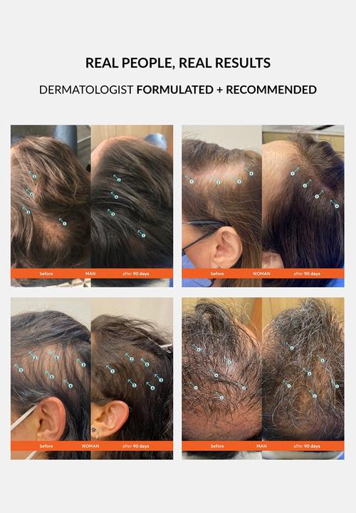 DS Laboratories  - Revita Hair Loss & Thinning Shampoo - 205ml
