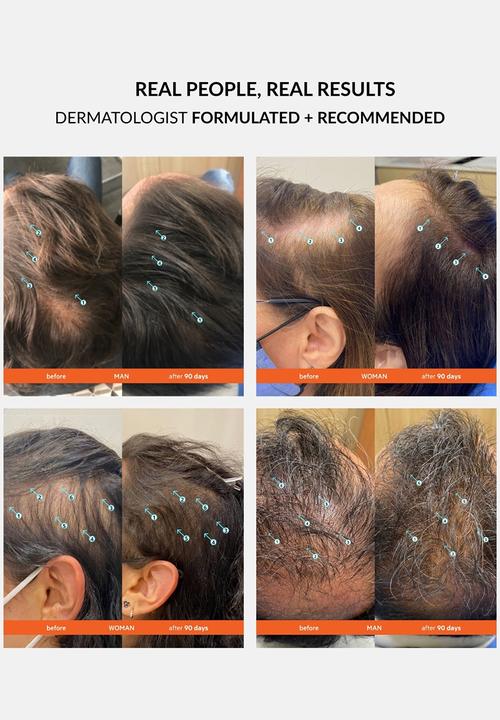 DS Laboratories  - Revita Hair Loss Support Conditioner - 205ml