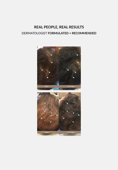 DS Laboratories  - Spectral Men’s Hair Density Treatment 3 Month Supply - 60ml x 3