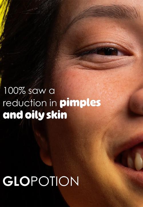 Skin Republic - GloPotion Niacinamide 10% + Rice Water Serum