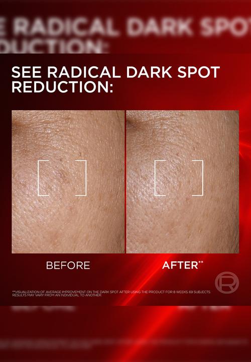 L'Oreal Paris - Revitalift Laser Triple Power Creamy Serum