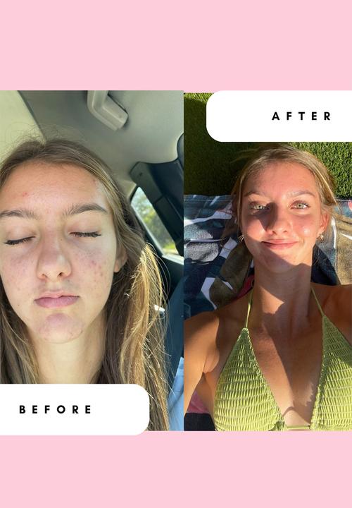 Standard Beauty - Aloe & Cucumber Toner with Niacinamide for Sensitive Skin
