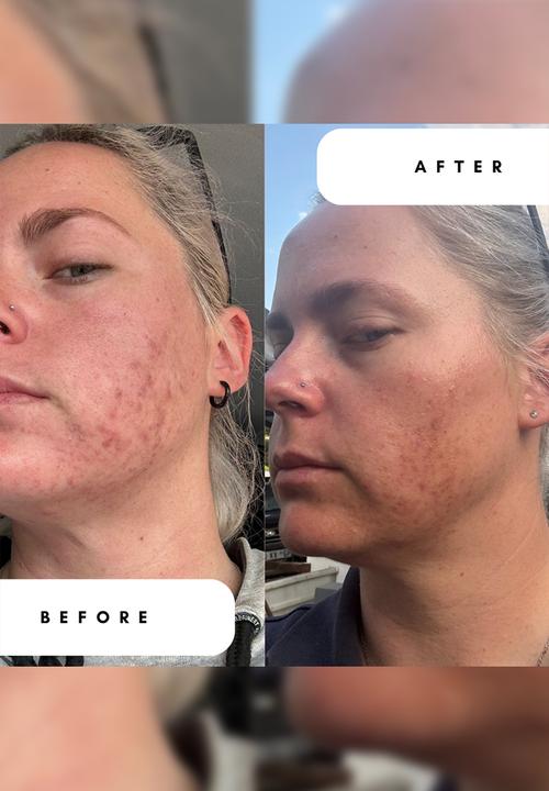 Standard Beauty - AHA Lactic Acid 5% Toner with Allantoin