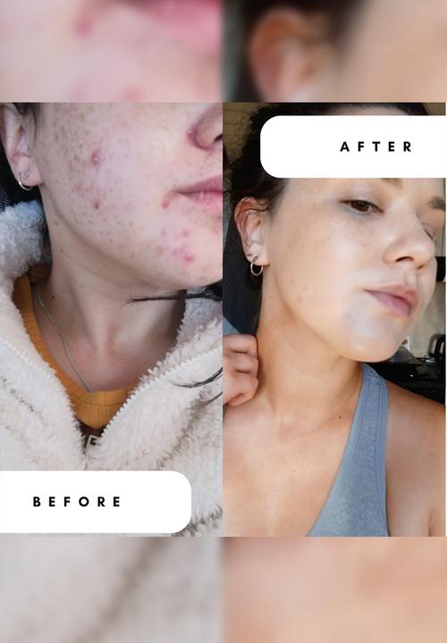 Standard Beauty - AHA Lactic Acid 5% Toner with Allantoin
