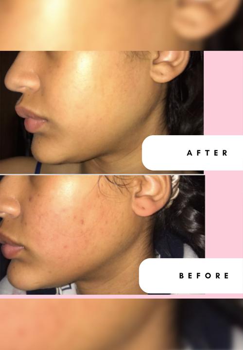 Standard Beauty - Moisture Bomb Lightweight Moisturiser