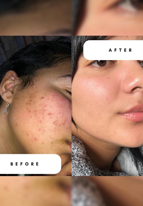 Standard Beauty - Advanced 0,3% Retinol with 1% Hyaluronic Acid & 2% Niacinamide