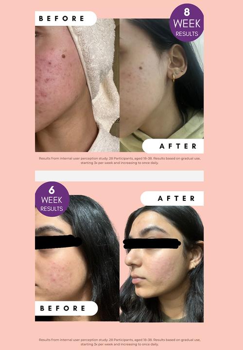 Standard Beauty - Pigmentation Buster Duo™ Dual-Phase Brightening System with Vitamin C & Alpha Arbutin