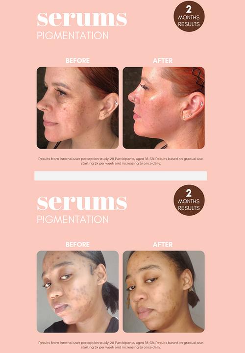 Standard Beauty - Pigmentation Buster Duo™ Dual-Phase Brightening System with Vitamin C & Alpha Arbutin