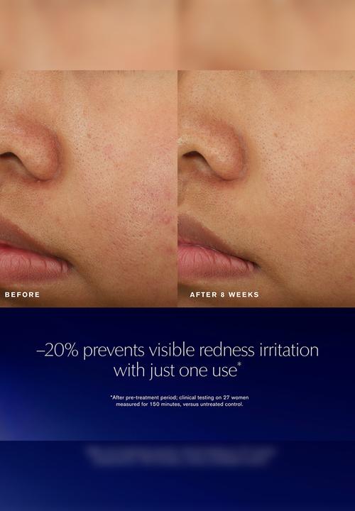 Estee Lauder - Advanced Night Repair Recovery Treatment Essence 100ml