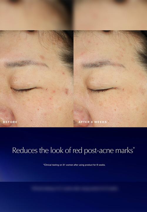 Estee Lauder - Advanced Night Repair Recovery Treatment Essence 100ml