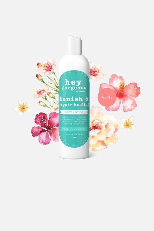 Banish & Repair Skin Healing Lotion