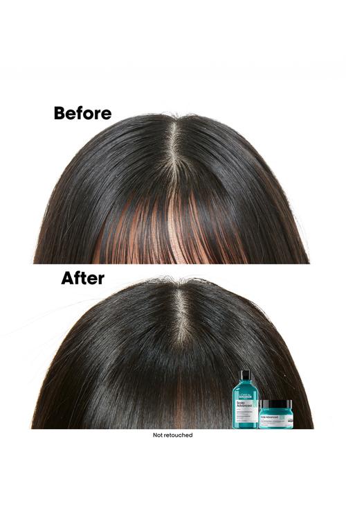 Scalp Care Anti-Oiliness Dermo Shampoo  - 300ml