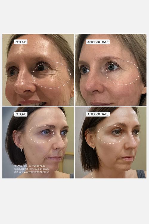 Retinin Night Face Cream Refill