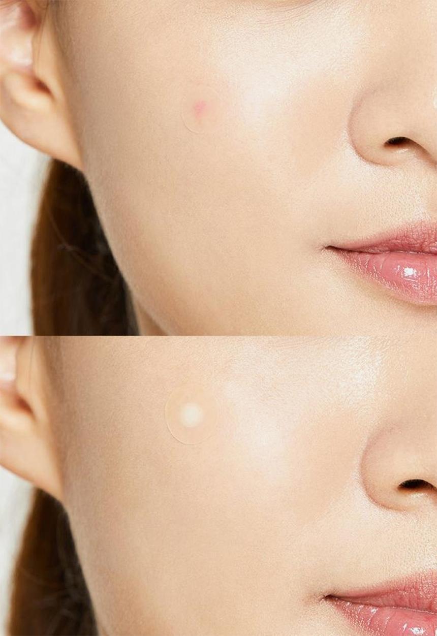COSRX - Acne Pimple Master Patch