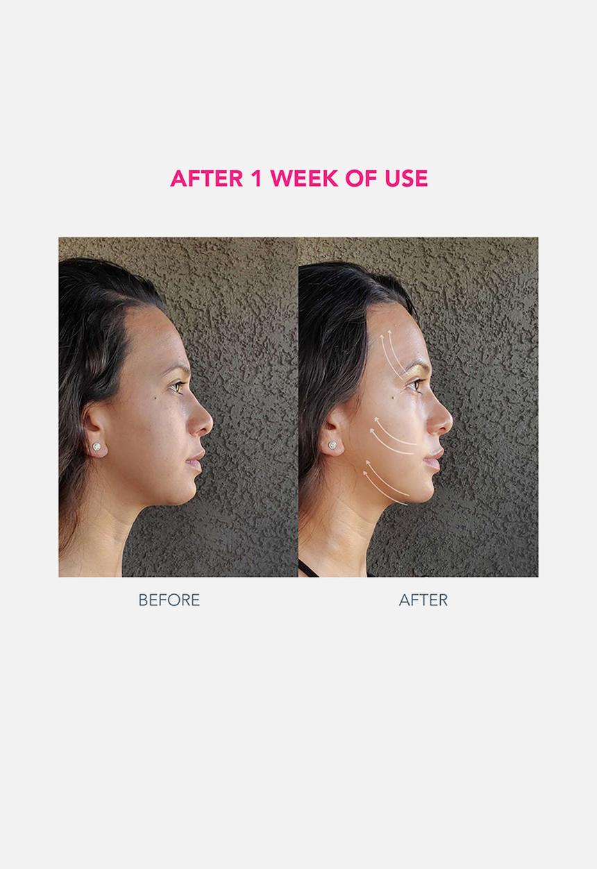 FOREO Sweden - BEAR™ Facelift - Fuchsia