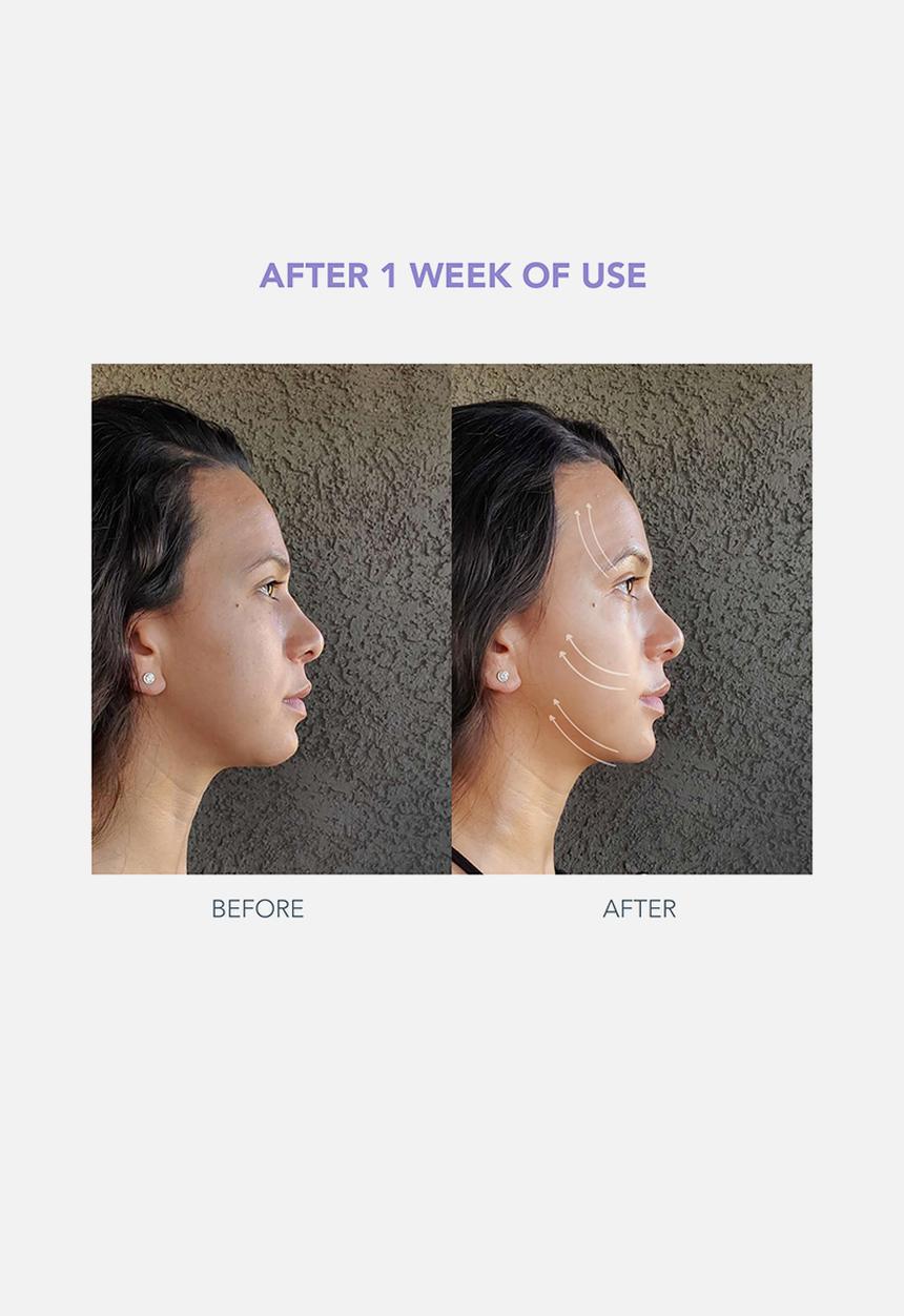 FOREO Sweden - BEAR™ Facelift Mini - Lavender