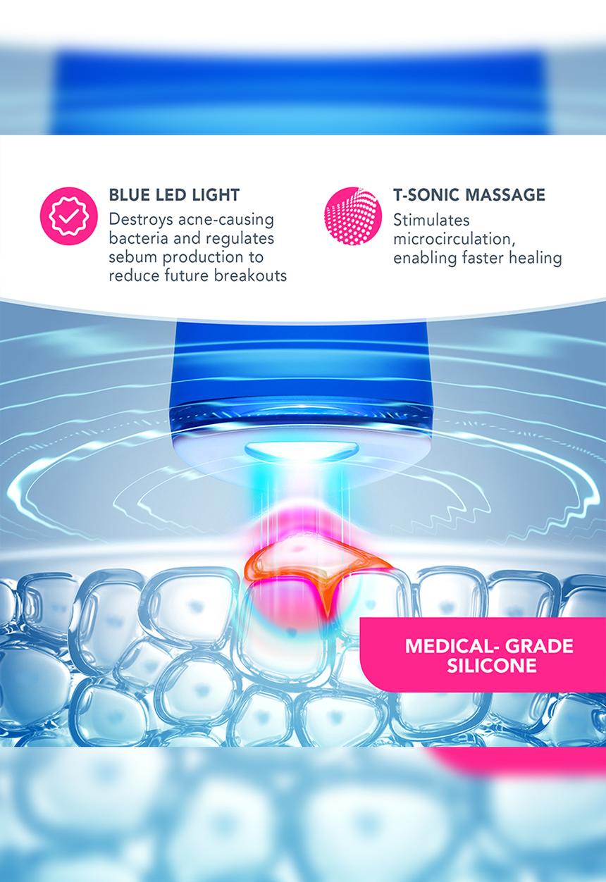 FOREO Sweden - ESPADA™ Acne Treatment - Fuchsia