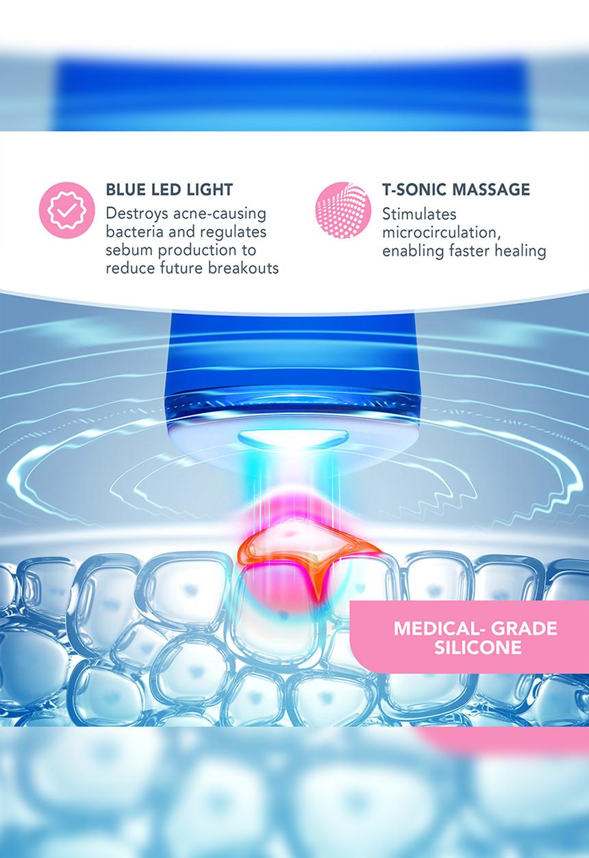 FOREO Sweden - ESPADA™ Acne Treatment - Pearl Pink