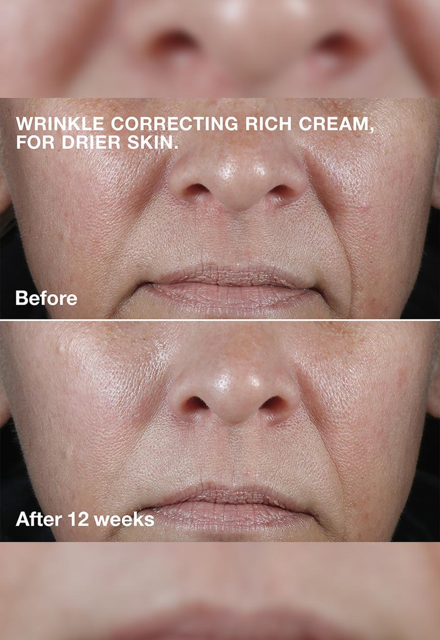 Clinique - Smart Clinical Repair™ Wrinkle Correcting Cream Mini