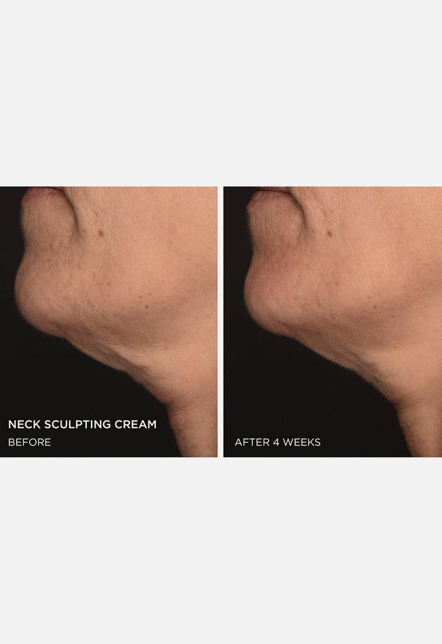 Dr.BRANDT - Needles No More Neck Sculpting Cream