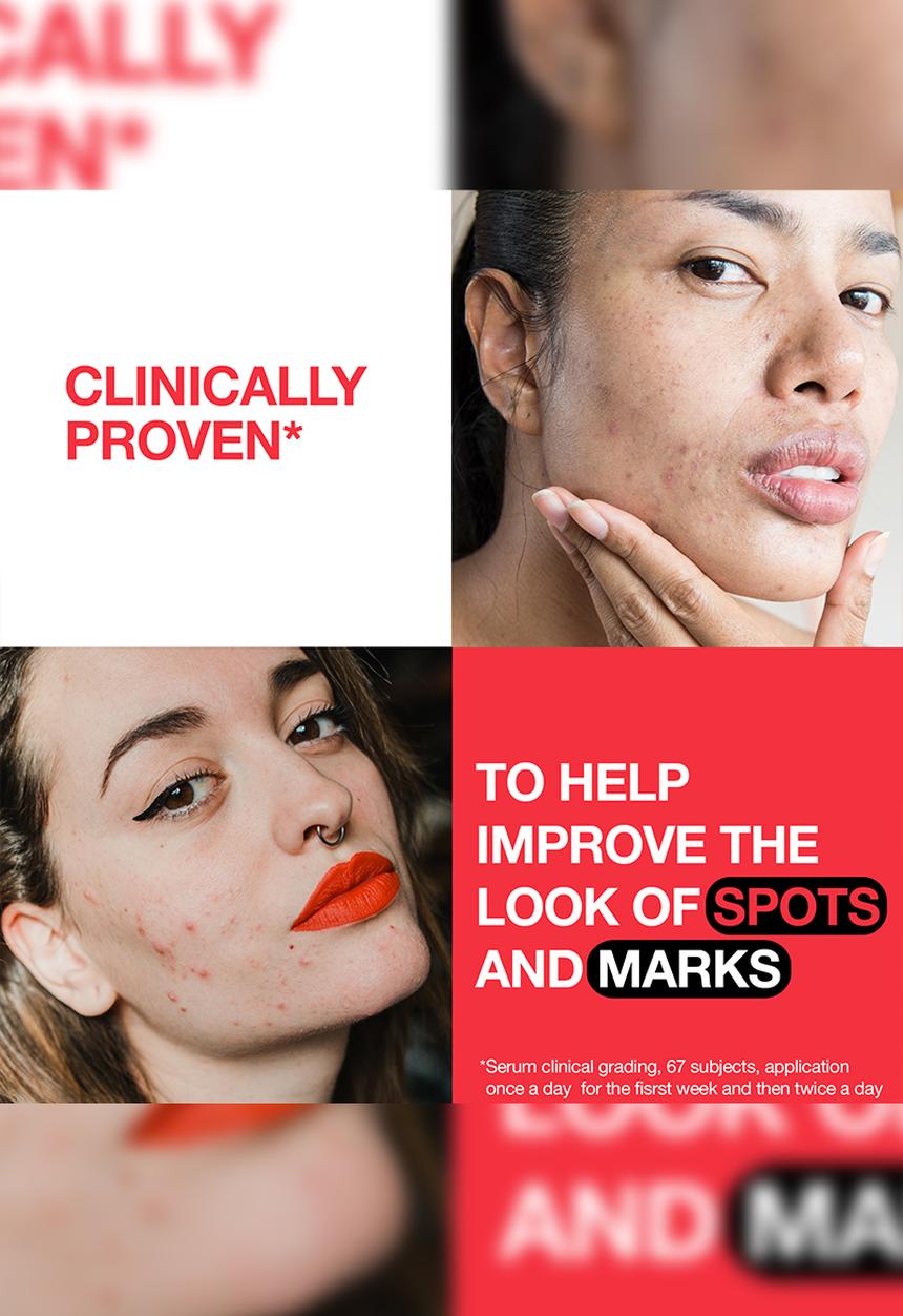 Neutrogena - Daily Serum Spot Controlling - 30ml