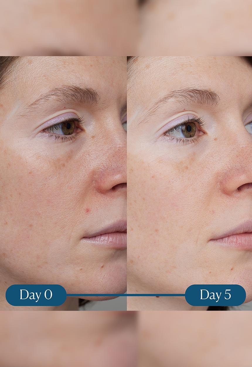 ELEMIS - Dynamic Resurfacing Super - C Serum