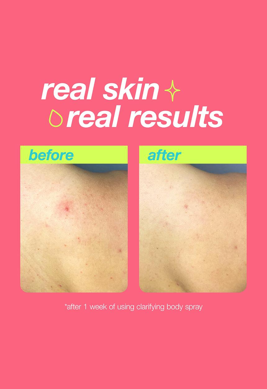Clear Start by dermalogica - Clarifying Body Spray