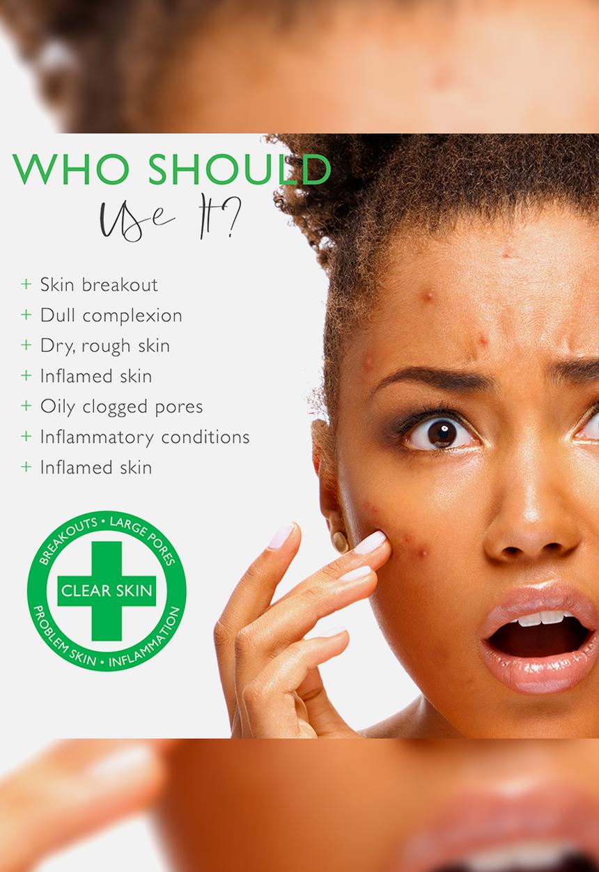 SKIN NUTRITION - Acne & Problem Skin Super Prescription