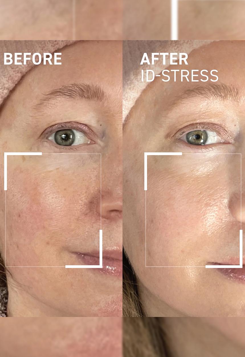 Dr.BRANDT - Icy Gel Moisturizer