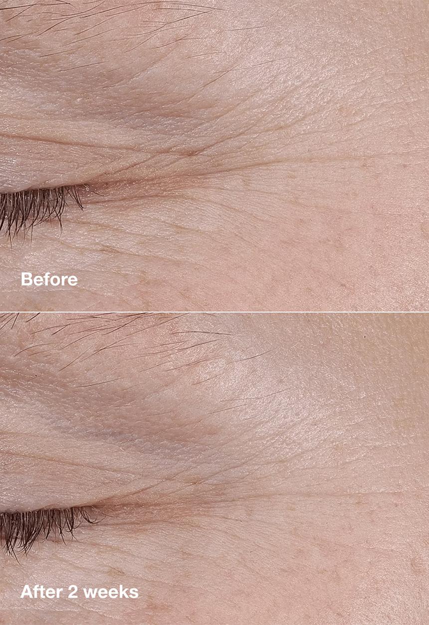 Clinique - Smart Clinical Repair AM/PM Retinoid Balm