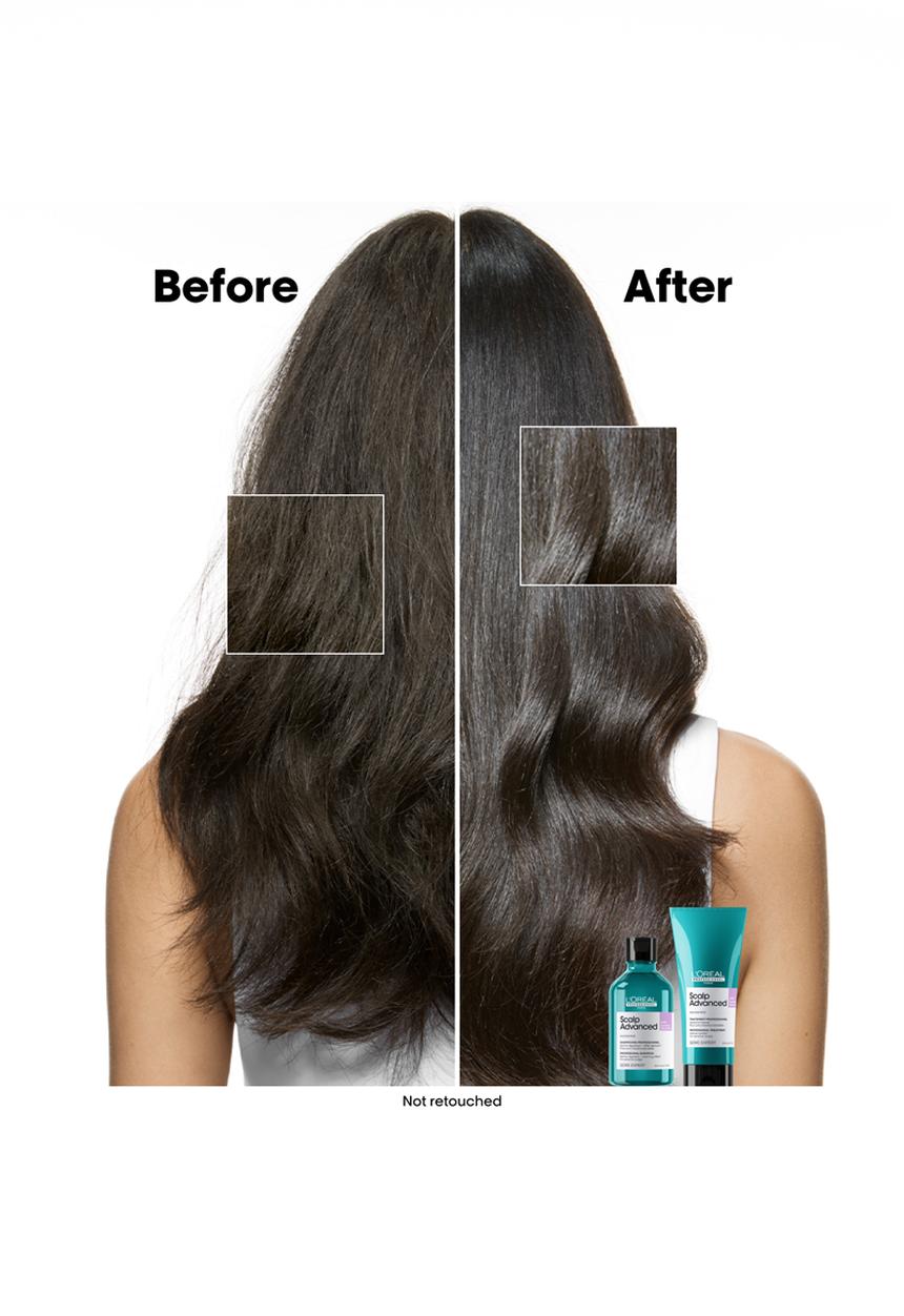 L’Oreal Professionnel - Scalp Care Anti-Dandruff Lightweight Shampoo 300ml