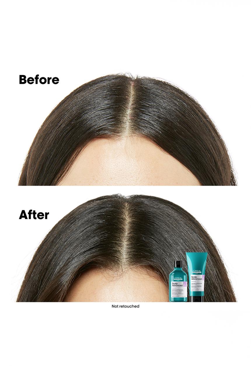 L’Oreal Professionnel - Scalp Care Anti-Dandruff Lightweight Shampoo 300ml