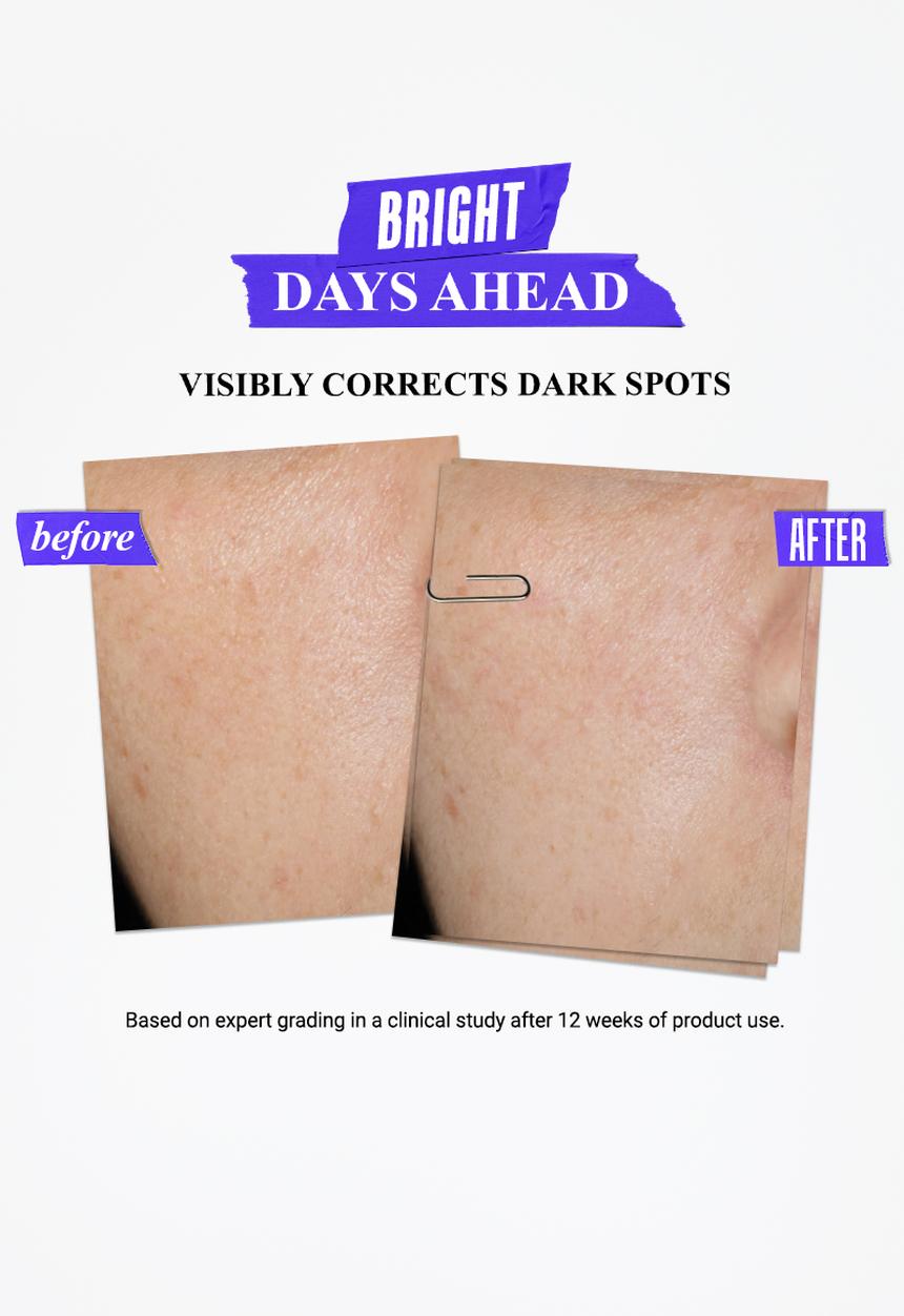 Kiehl's - Clearly Corrective™ Dark Spot Solution
