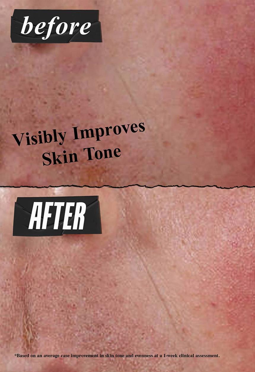 Kiehl's - Ultra Facial Advanced Repair Barrier Cream