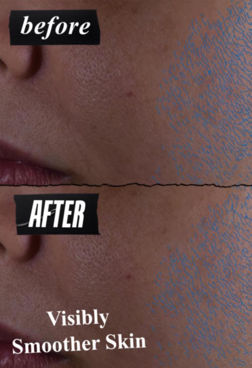 Kiehl's - Clearly Corrective™ Daily Re-Texturizing Triple Acid Peel Serum