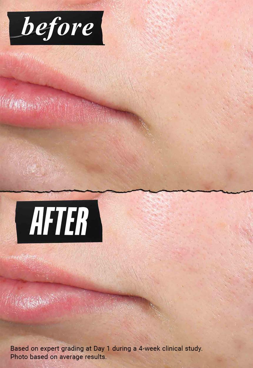 Kiehl's - Truly Targeted Blemish-Clearing Solution