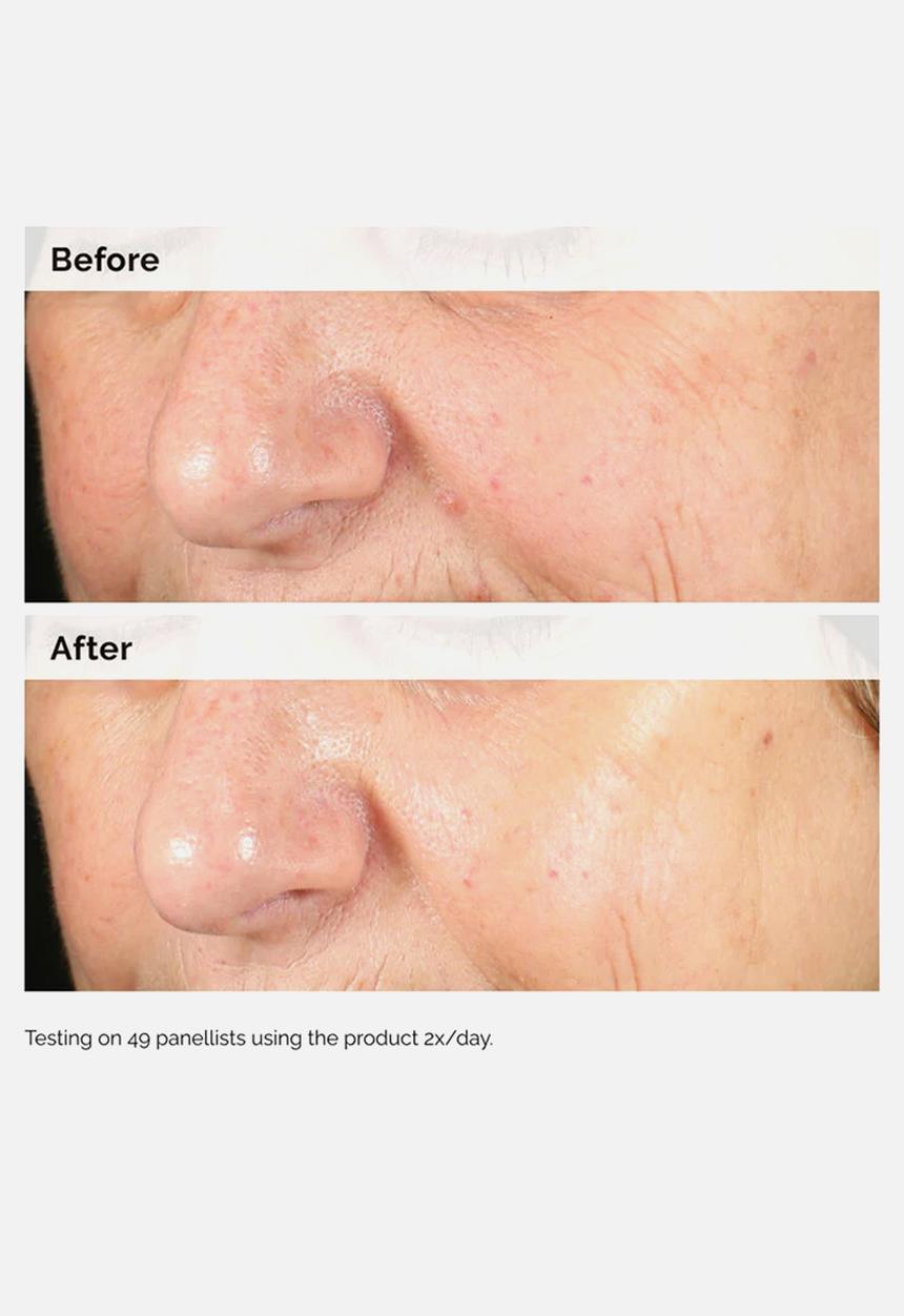 The Ordinary. - Alpha Arbutin 2% + HA 30ml