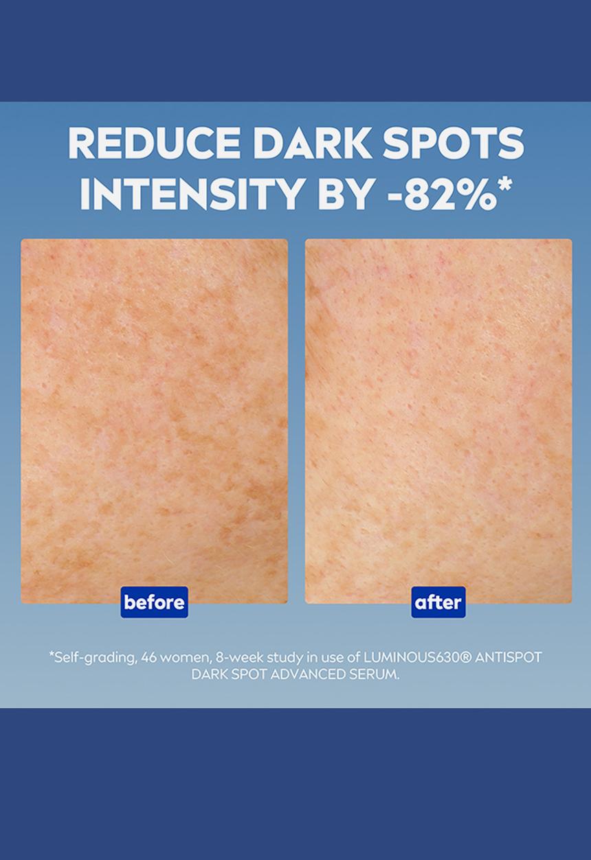 Nivea - Perfect and Radiant LUMINOUS630 Anti Dark Marks Treatment Serum - 30ml