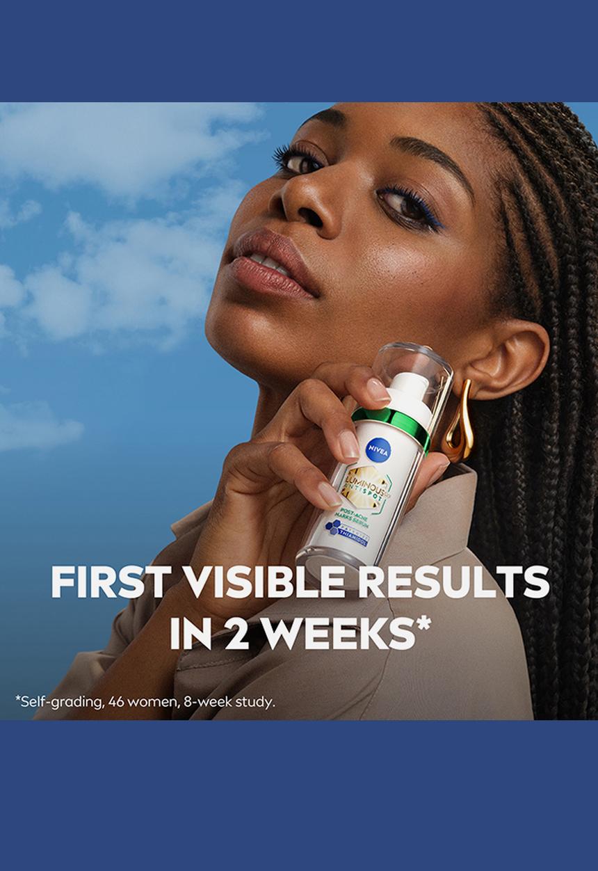 Nivea - Perfect and Radiant Luminous 630 Anti Dark Marks Post Acne Serum - 30ml