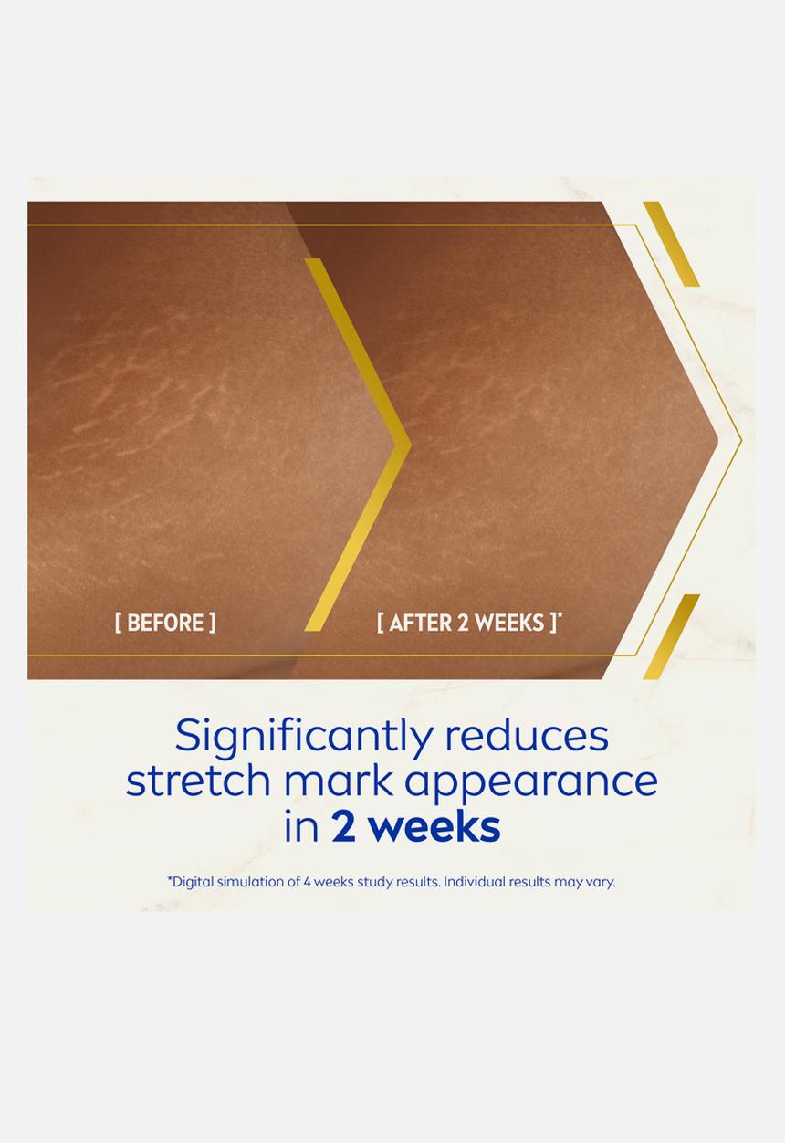 Nivea - LUMINOUS630 Anti Stretch Marks Body Oil-Serum - 100ml