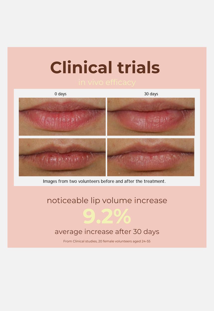 Standard Beauty - Peptide Lip Glaze with Hyaluronic Acid