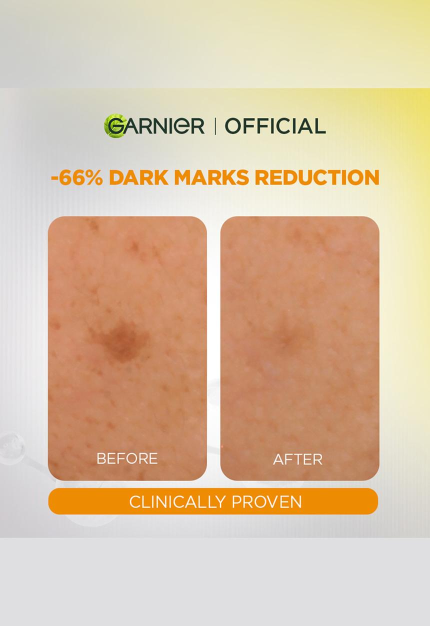Garnier - SkinActive Even & Bright - Vitamin C Booster Serum 30ml