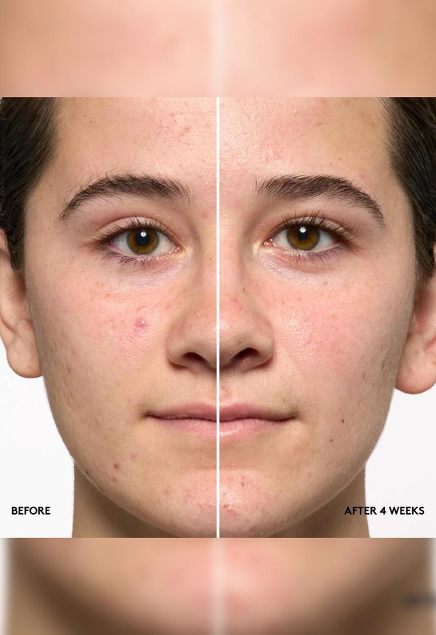 Fenty Beauty - Hydra Vizor SPF 20