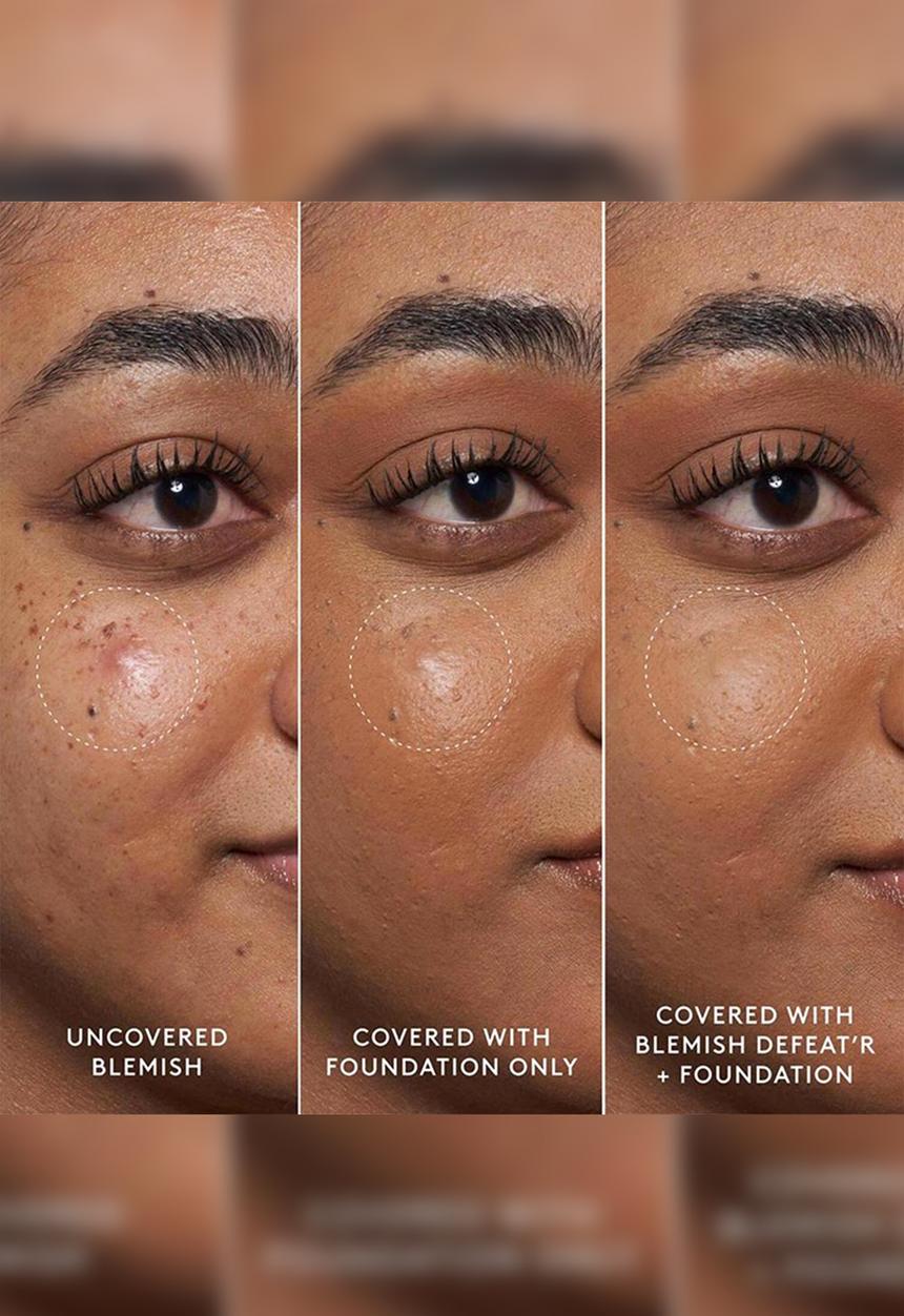 Fenty Beauty - Fenty Blemish Defeat?r BHA Spot-Targeting Gel