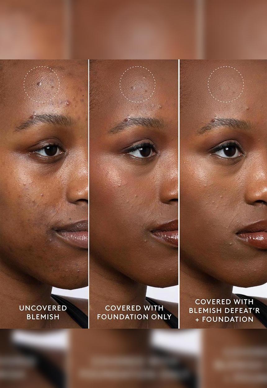 Fenty Beauty - Fenty Blemish Defeat?r BHA Spot-Targeting Gel