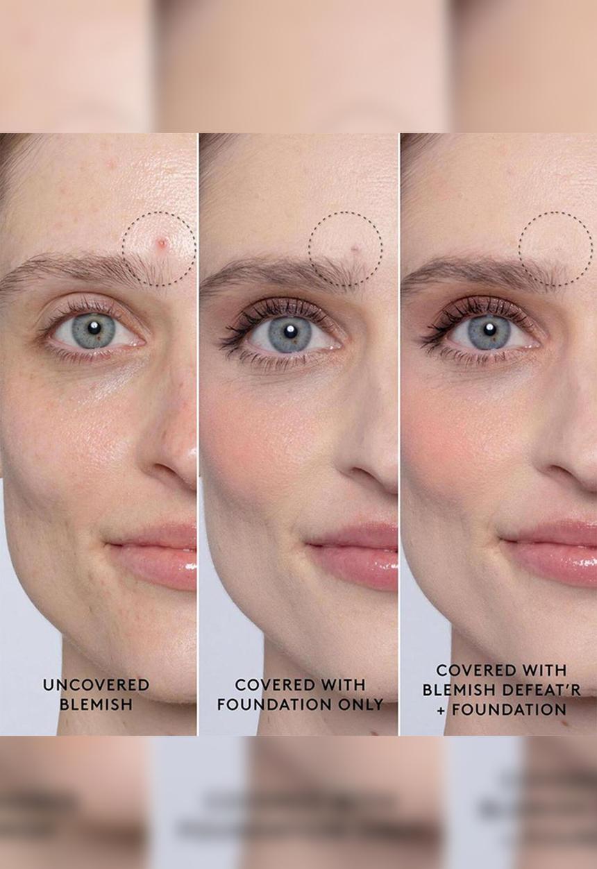 Fenty Beauty - Fenty Blemish Defeat?r BHA Spot-Targeting Gel