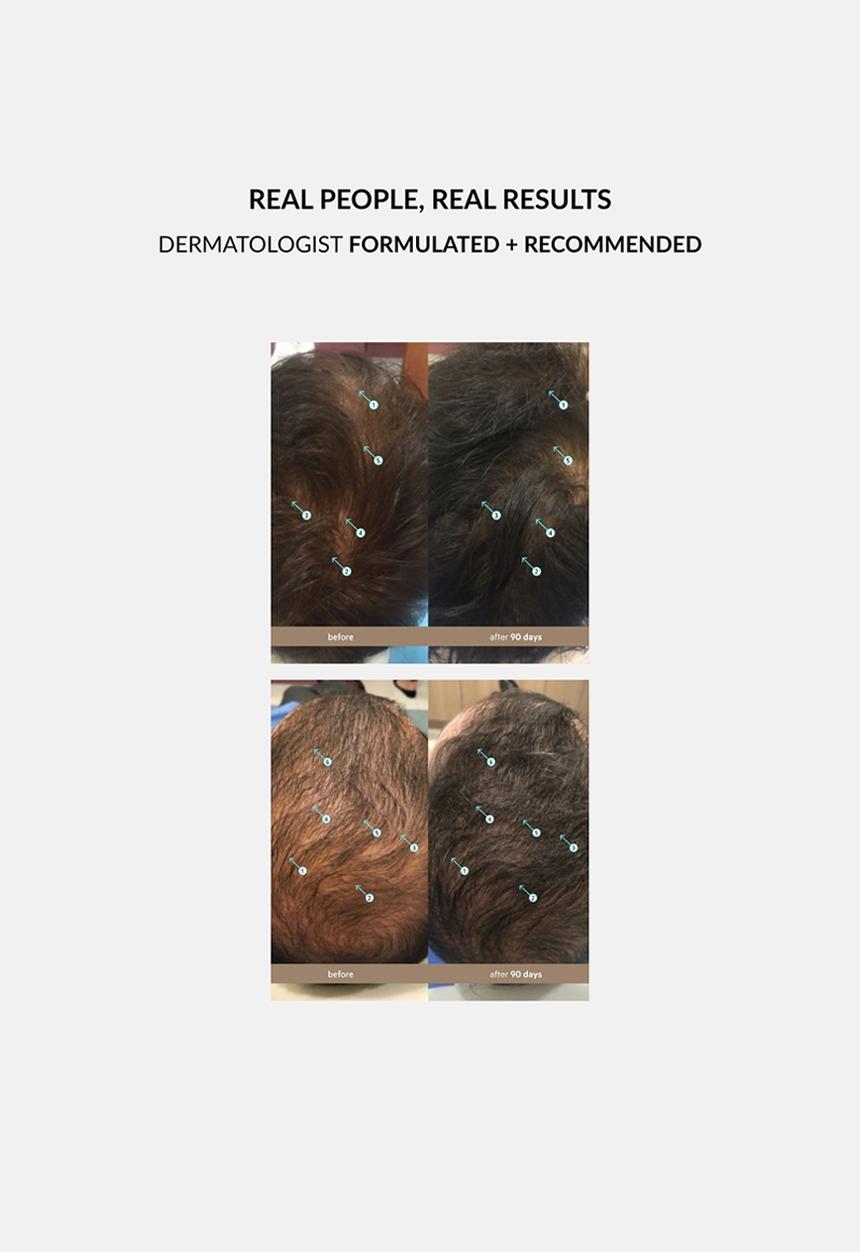 DS Laboratories  - Spectral Men’s Hair Density Treatment 5% Nanoxidil - 60ml